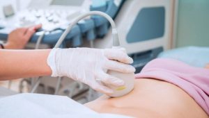 Ovarios poliquísticos: Las dudas frecuentes al planificar un embarazo